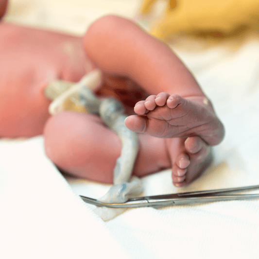 Why We Recommend Delayed Cord Clamping - Your Mindful Mama